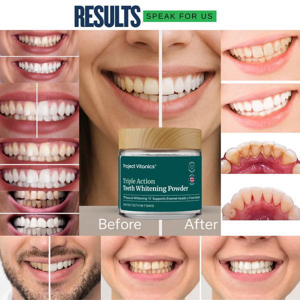 Advanced Teeth Whitening Powder Pap+ Mineral-Rich & Plaque Control Formula for Enamel Care - Enzyme Based Tooth Whitening with Nano Hydroxyapatite, Xylito, Papain - Enamel Safe – Non-Peroxide